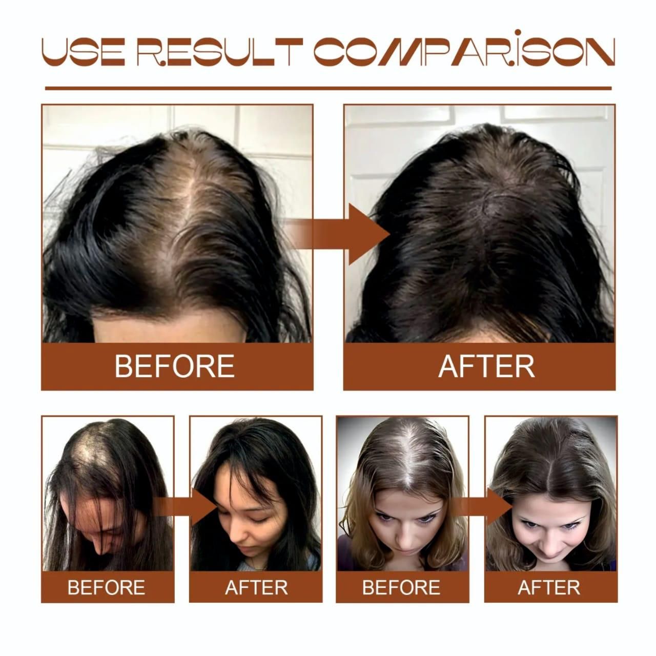 Batana Oil 120ml Pack of 2